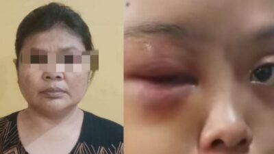Sadis, Anak Yatim Dipukuli dan Diinjak Tantenya Hingga Alami Luka di Tarai Bangun